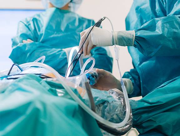 Variceal Ligation-img